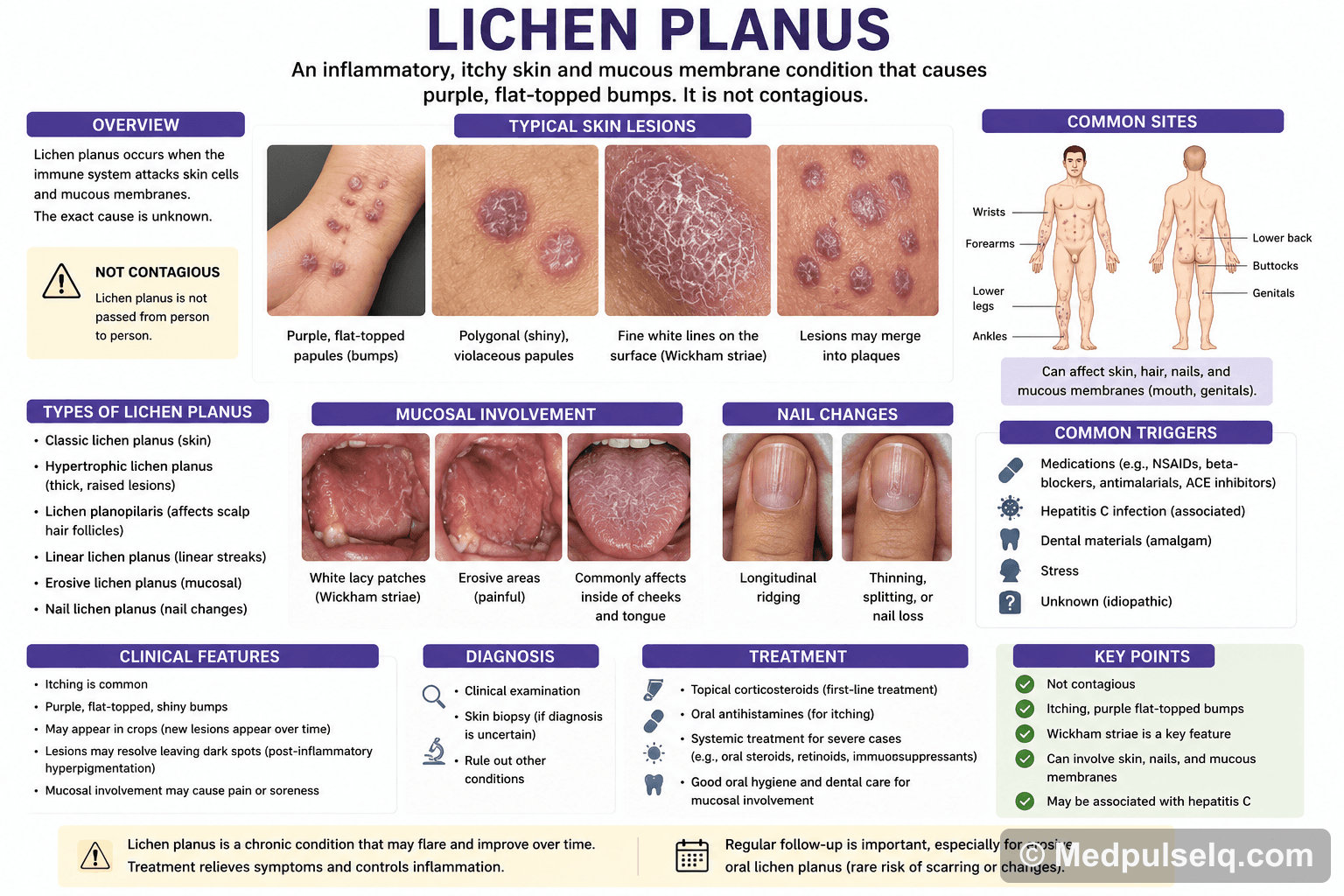 Lichen planus — Dermatology