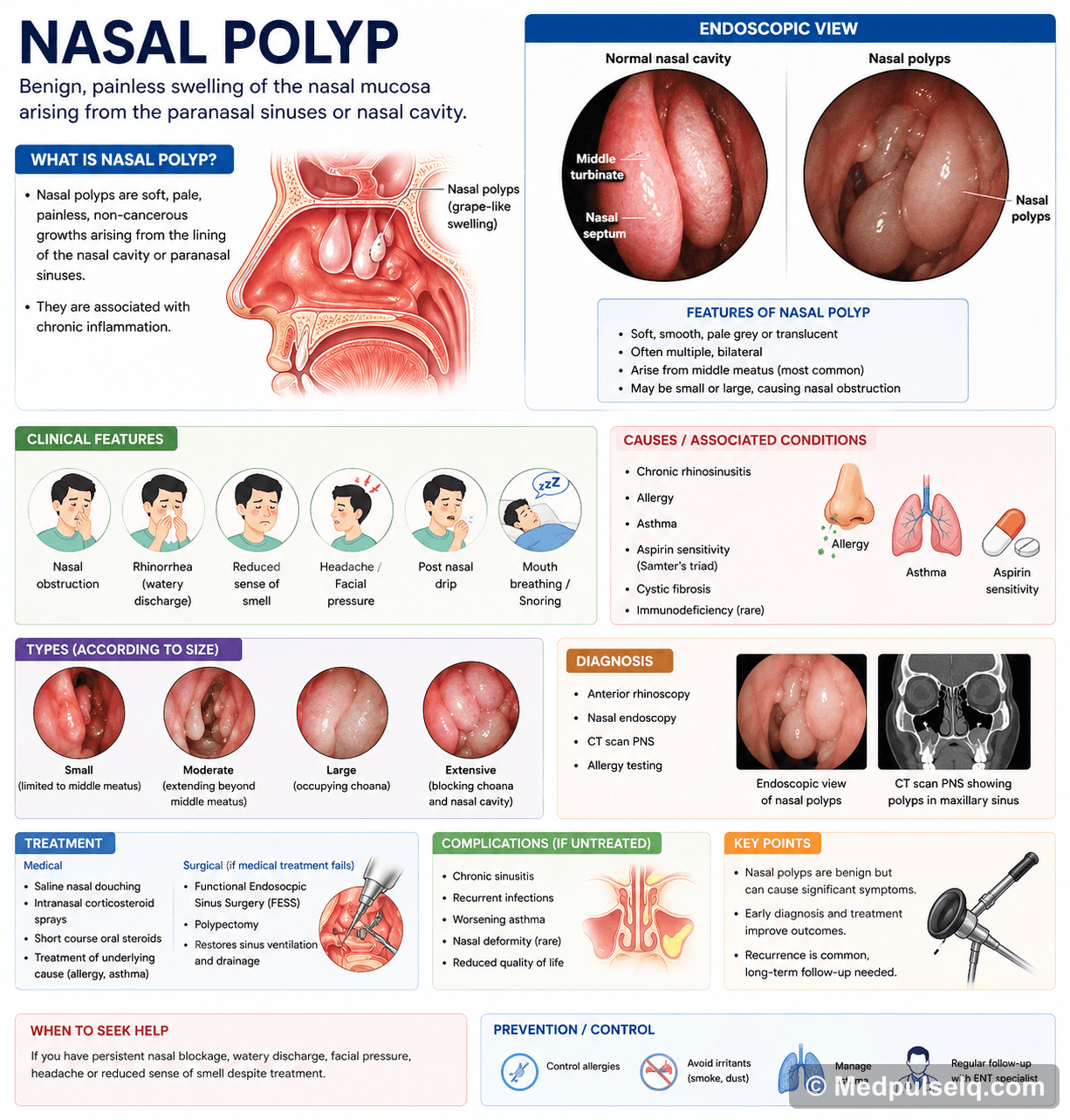 Nasal polyp — ENT