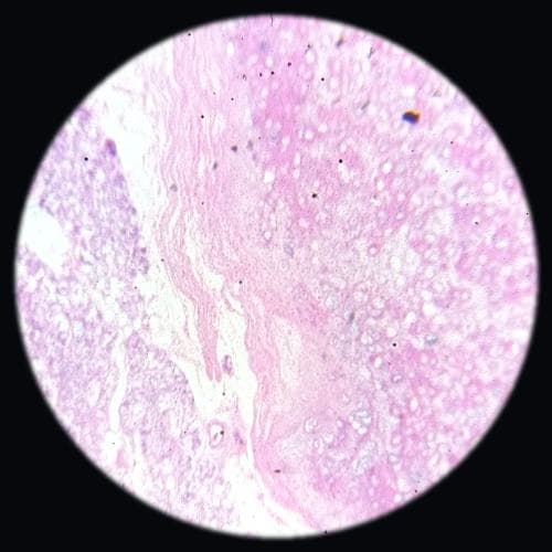 Elastic cartilage — photographed field 3