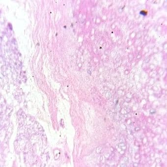 Elastic cartilage