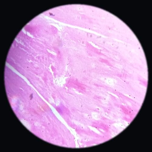 White fibrocartilage — photographed field 5