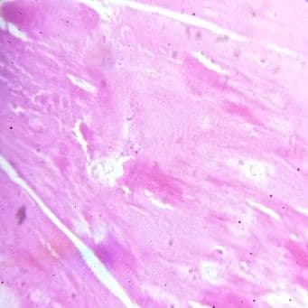 White fibrocartilage