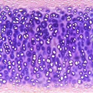 Hyaline cartilage