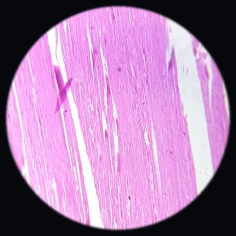 Skeletal muscle — photographed field 9