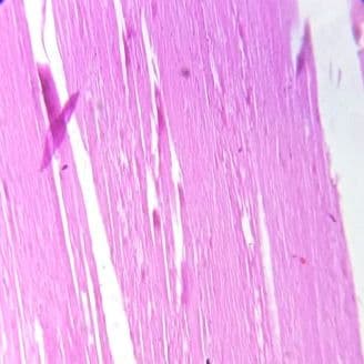 Skeletal muscle