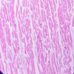 Cardiac muscle