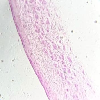 Large vein
