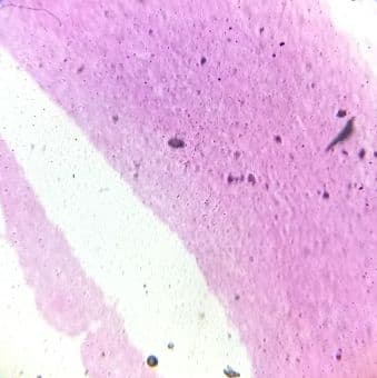 Large artery