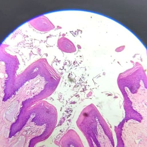 Tongue — fungiform papilla