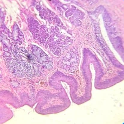 Tongue — circumvallate papilla (CVP)