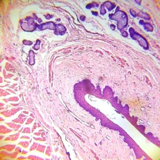 Oesophagus