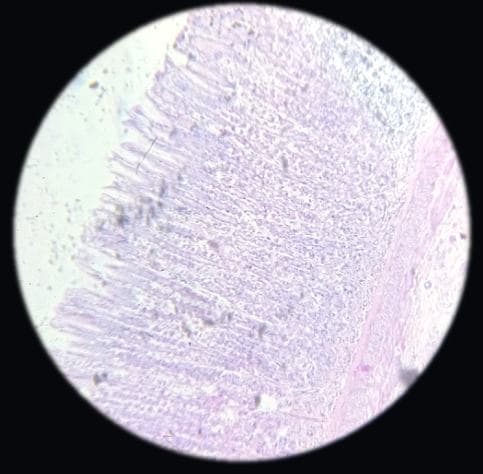 Stomach — fundus — photographed field 21