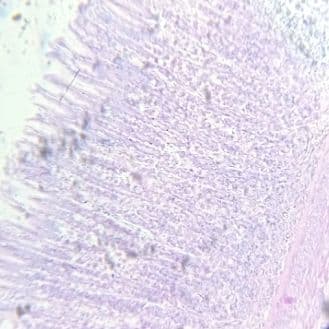Stomach — fundus
