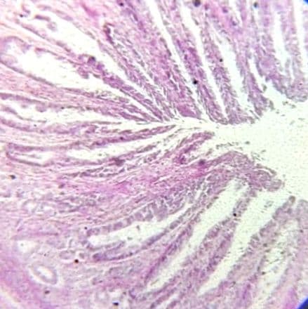 Stomach — pylorus