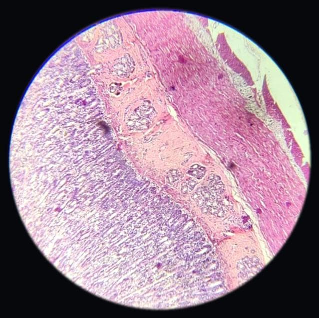 Duodenum — photographed field 25