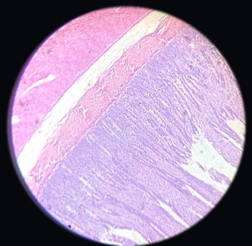 Jejunum — photographed field 26