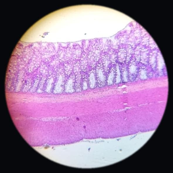 Large intestine (colon) — photographed field 30