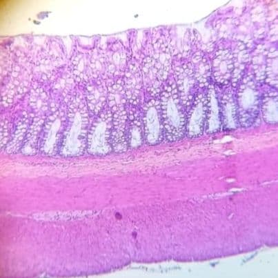 Large intestine (colon)