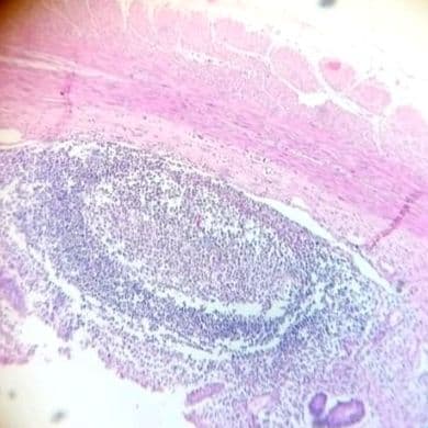 Appendix