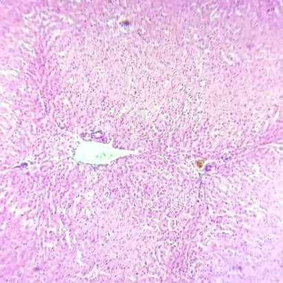 Liver