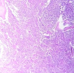 Spleen
