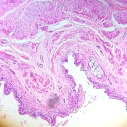 Gallbladder