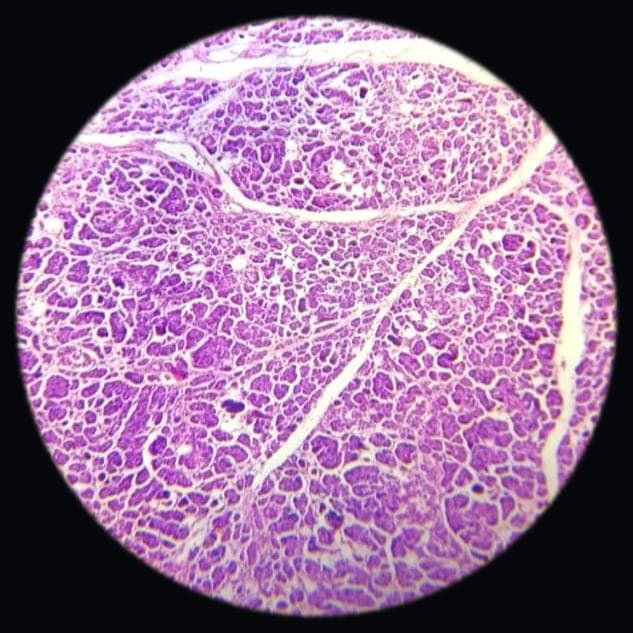 Pancreas — photographed field 35