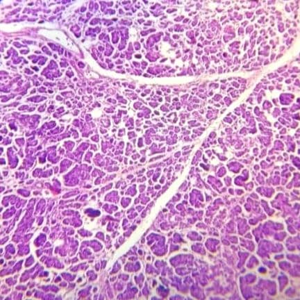 Pancreas