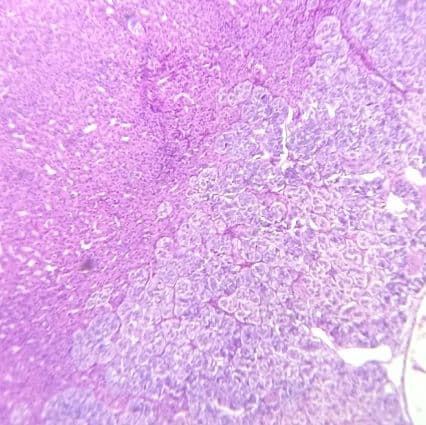 Suprarenal (adrenal) gland