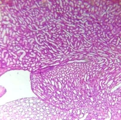Kidney