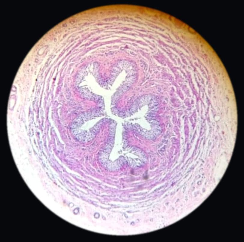 Ureter — photographed field 38