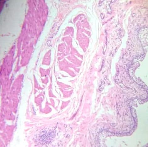 Urinary bladder