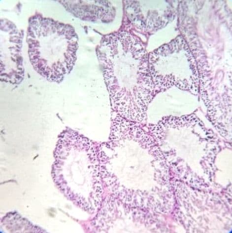 Testis