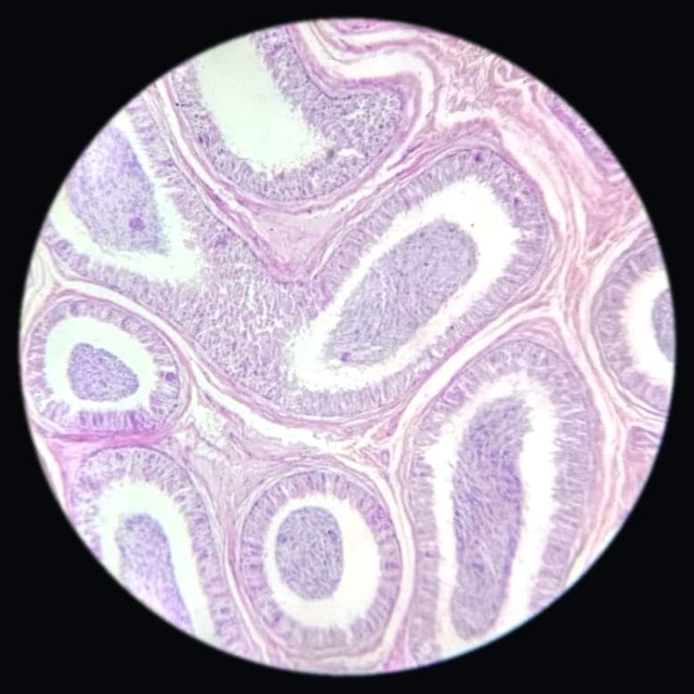 Epididymis — photographed field 42
