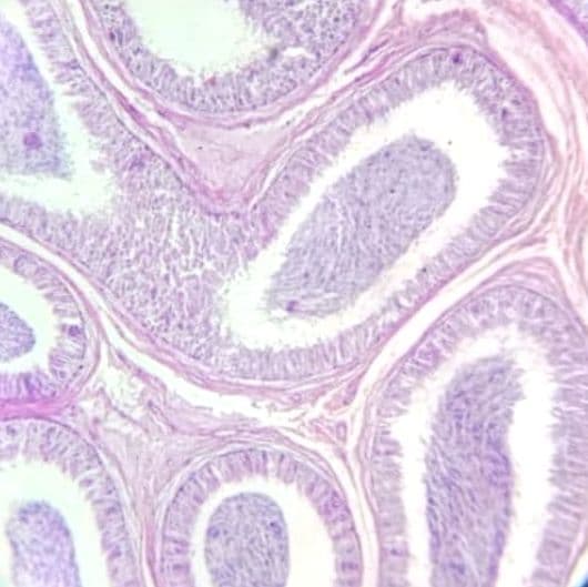 Epididymis