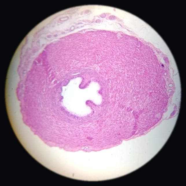 Vas deferens — photographed field 43