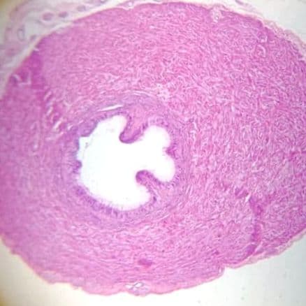 Vas deferens
