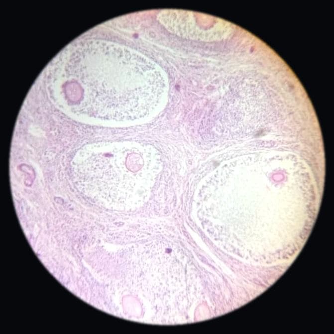 Ovary — photographed field 44