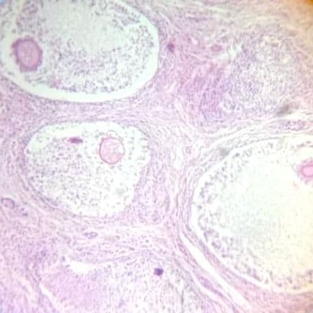 Ovary
