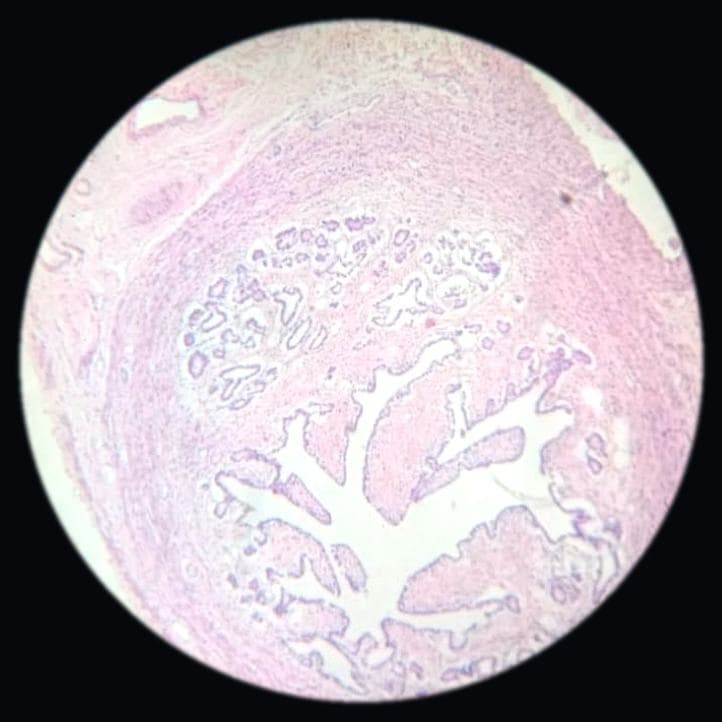 Fallopian tube — photographed field 45