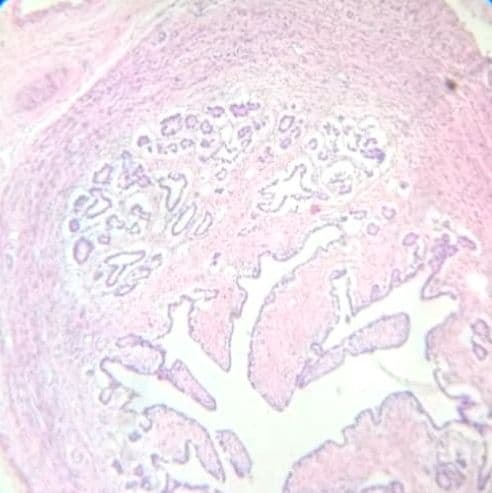 Fallopian tube