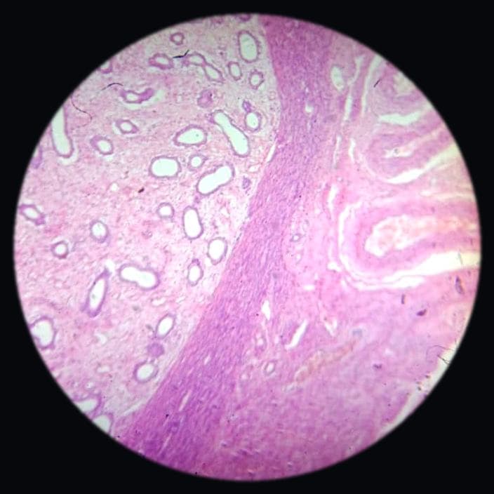 Uterus — photographed field 47