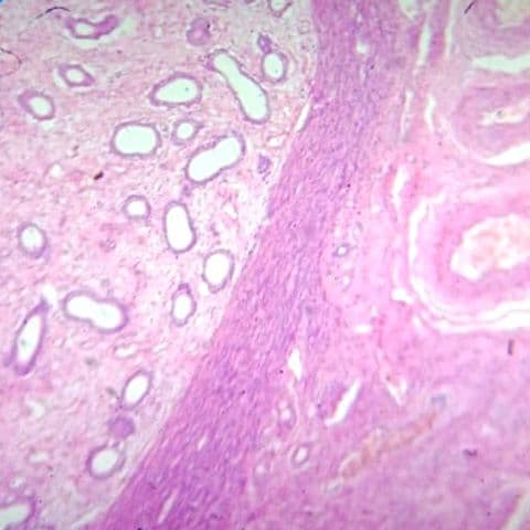 Uterus