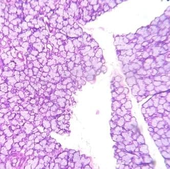 Mucous salivary gland