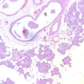 Serous salivary gland