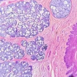 Tonsil
