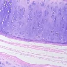 Trachea