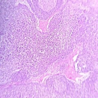 Lymph node