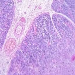Thymus
