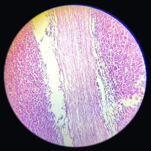 Pituitary gland — photographed field 60